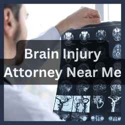 Brain Injury Attorney Near Me