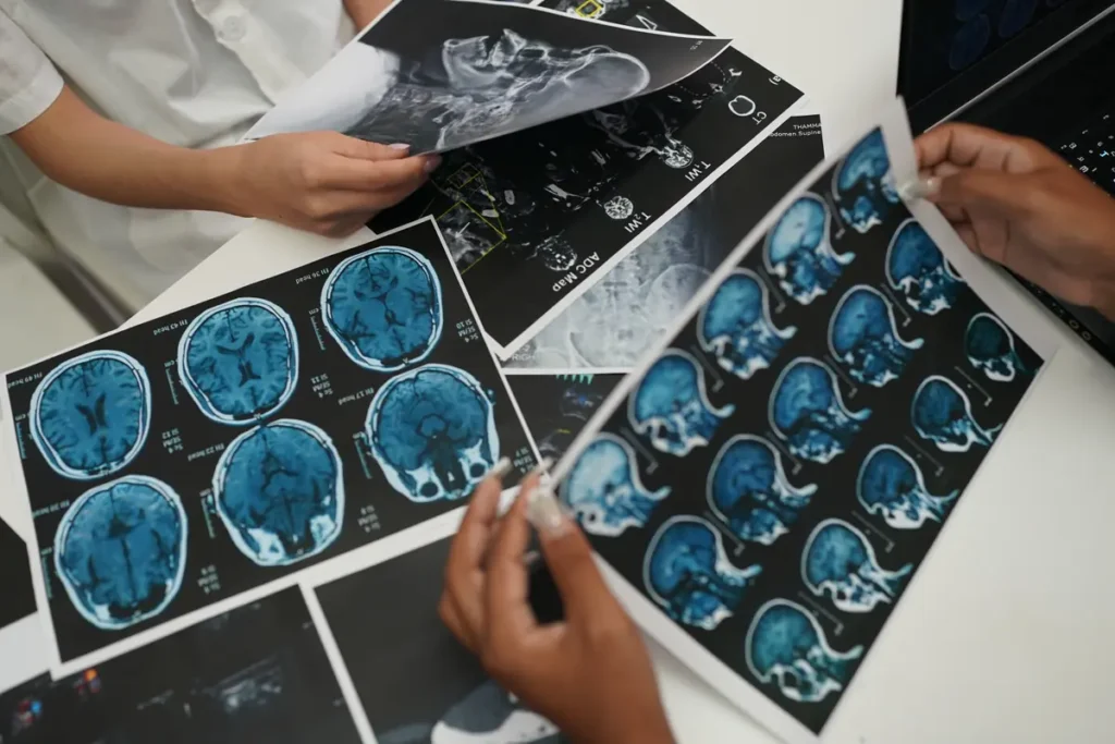 Doctor reviews brain scans on a desk
