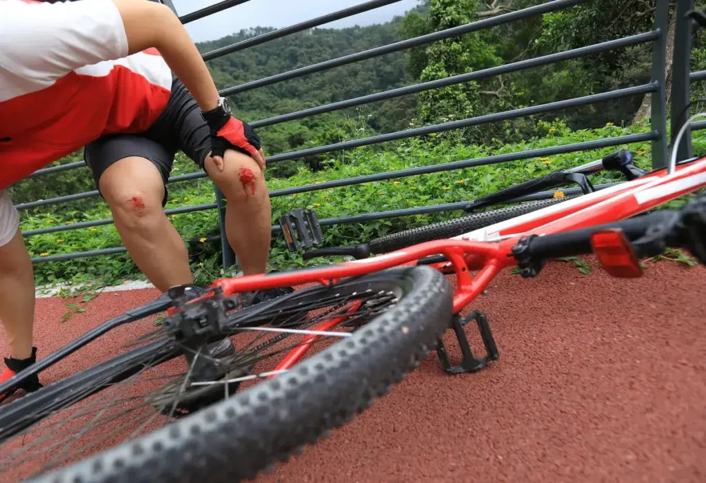 Cyclist with scraped, bleeding knees beside a fallen bike