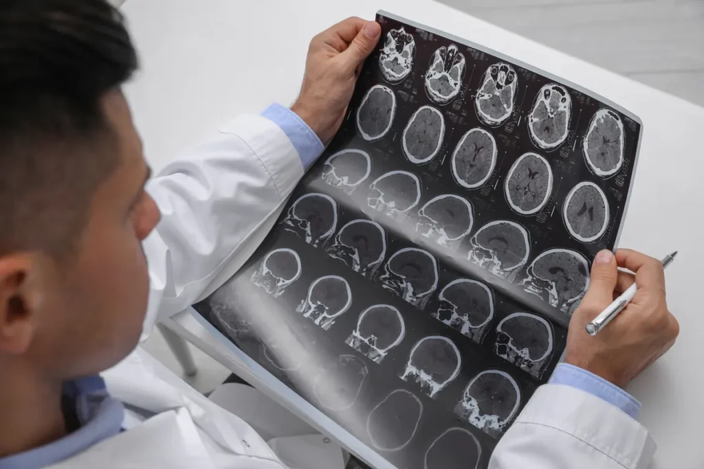 Doctor reviews brain scan films
