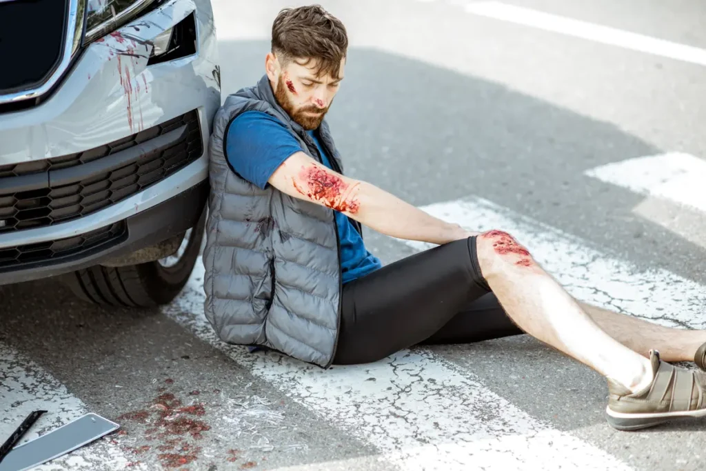 Injured man sits on the road next to a car
