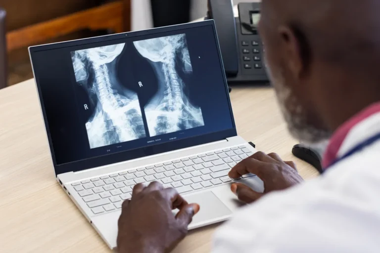 Doctor reviews spine X-rays on a laptop after a car accident